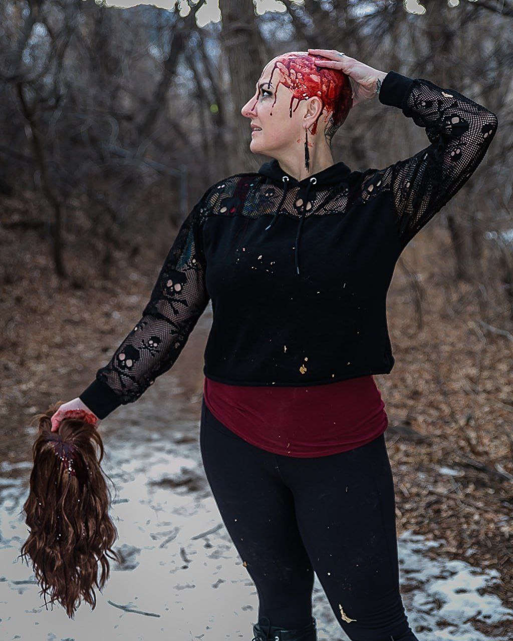 bloodyAlopecia